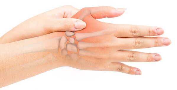 Stenosing ligamentitis locks the finger in a flexed position. 