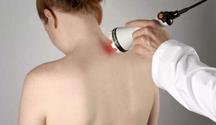 Physiotherapy method to treat cervical osteochondrosis