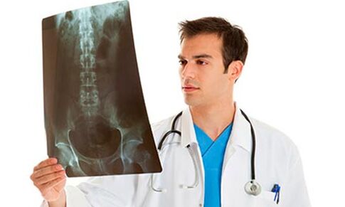 Doctor looking at x-ray to diagnose lower back pain.